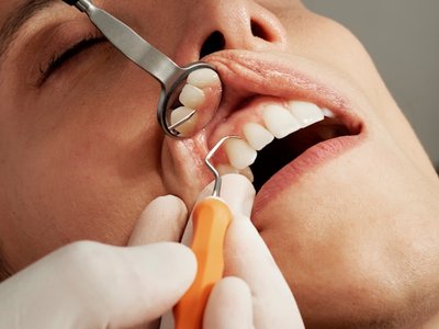 Cu�ndo un absceso dental se convierte en una urgencia m�dica