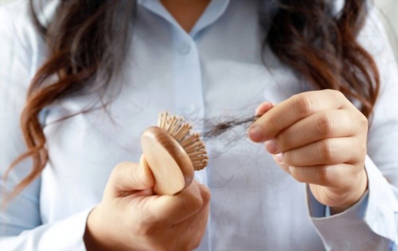Estr�s Laboral y Ca�da del Cabello: Una Relaci�n Inesperada